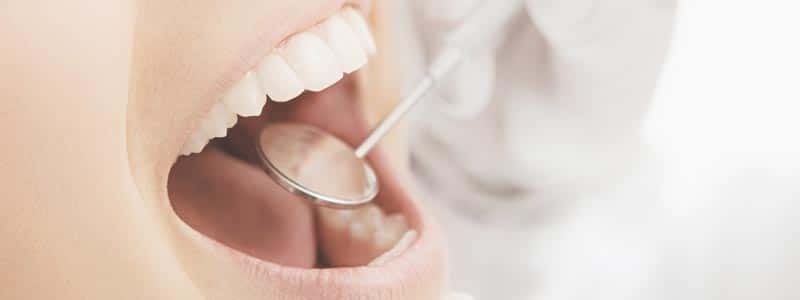 Cuidado de los implantes dentales - Revisiones en clínica
