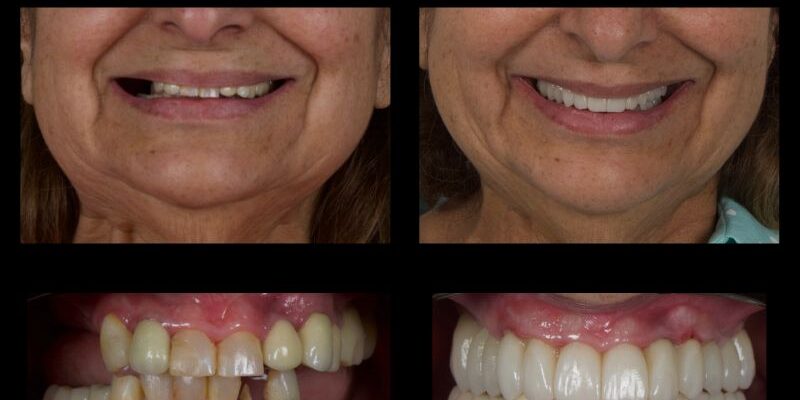 casos complejos 800x400 1 - Blog de Clínica Dental Badanelli